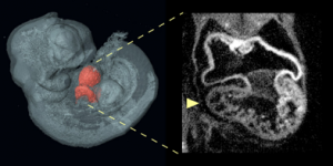 An optical projection tomography of an E10.5 Nipbl+/- embryo shows on the left a three-dimensional reconstruction of embryo with heart highlighted in red; on the right is optical section through the heart showing abnormally small right ventricle in the Nipbl+/- mouse.    Credit: Benedikt Hallgrimsson/University of Calgary 